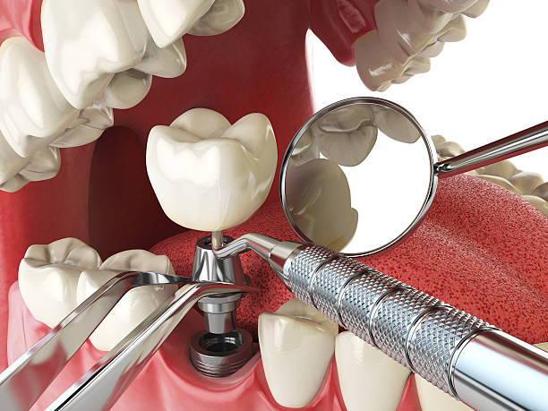 Best Urgent Tooth Repair  in Knoxville, IA